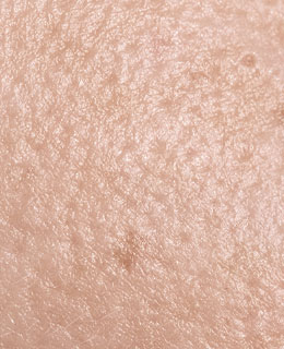 粗糙不平的男性肌膚