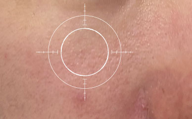 混合肌 使用毛孔緊緻亮膚精華水後 改善膚況